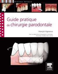 François Vigouroux - Guide pratique de la chirurgie parodontale.