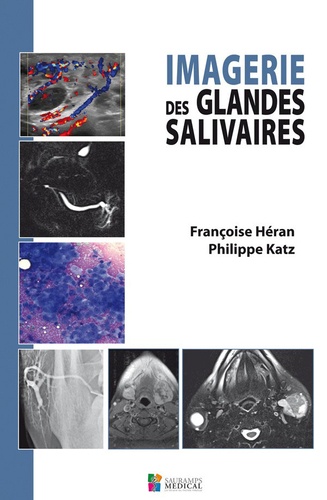 Françoise Héran et Philippe Katz - Imagerie des glandes salivaires.