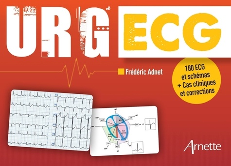 URG' ECG