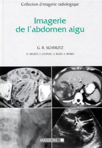 Frédéric Chapuis et Denis Régent - Imagerie de l'abdomen aigu.
