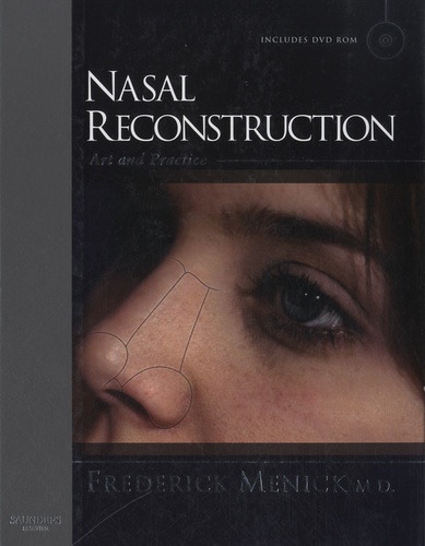 Frederick J. Menick - Nasal Reconstruction - Art and Practice. 1 DVD