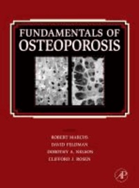 Fundamentals of Osteoporosis.