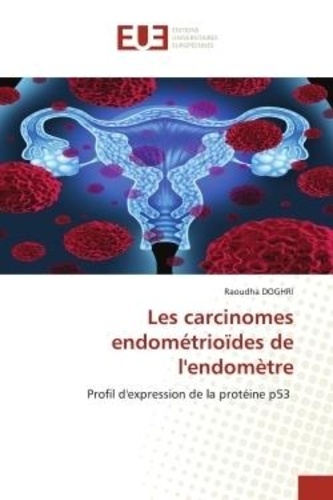 Raoudha Doghri - Les carcinomes endométrioïdes de l'endomètre - Profil d'expression de la protéine p53.