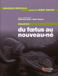 Imagerie du foetus au nouveau-né