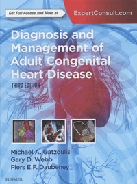 Diagnosis and Management of Adult Congenital Heart Disease
