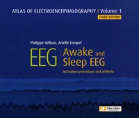 Atlas of Electroencephalography