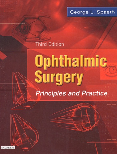 George-L Spaeth - Ophthalmic Surgery. Principles And Practice, 3rd Edition.