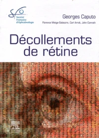 Décollements de rétine