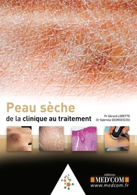 Peau sèche.pdf