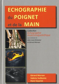 Echographie du poignet et de la main