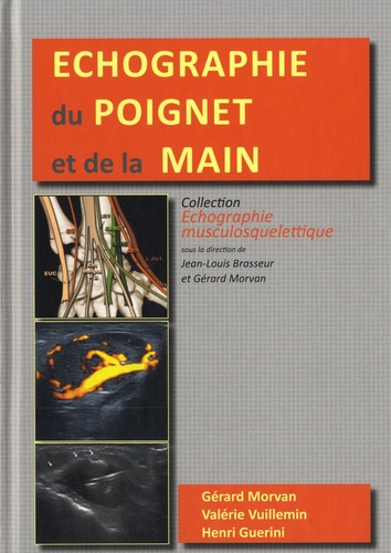 Gérard Morvan et Valérie Vuillemin - Echographie du poignet et de la main.