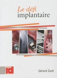 Le Défi implantaire