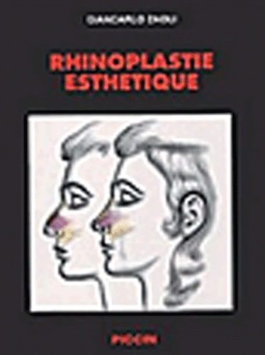 Giancarlo Zaoli - Rhinoplastie esthétique.
