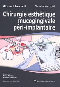 Giovanni Zucchelli et Claudio Mazzotti - Chirurgie esthétique mucogingivale péri-implantaire - 2 volumes.