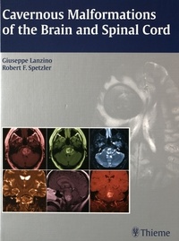 Cavernous Malformations of the Brain and Spinal Cord.pdf