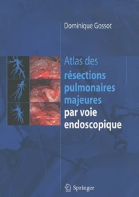 Atlas des résections pulmonaires majeures par voie endoscopique
