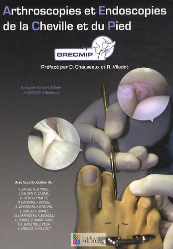  GRECMIP - Arthroscopies et endoscopies de la cheville et du pied.