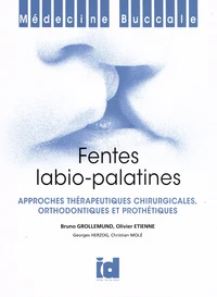Fentes labio-palatines