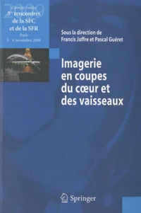 Imagerie en coupes du coeur et des vaisseaux