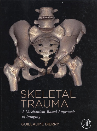 Skeletal Trauma. A Mechanism-Based Approach of Imaging