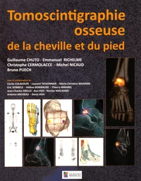 Tomoscintigraphie osseuse de la cheville et du pied