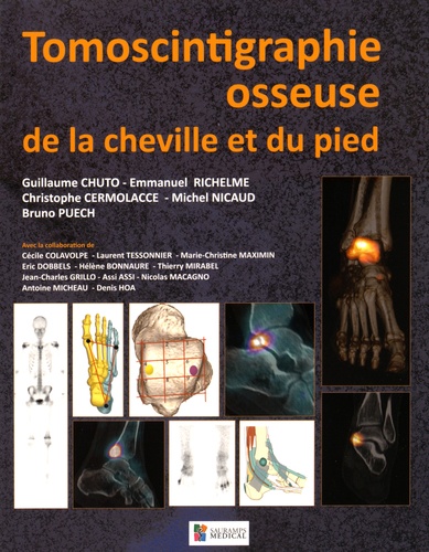 Guillaume Chuto et Emmanuel Richelme - Tomoscintigraphie osseuse de la cheville et du pied.