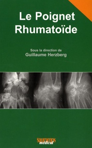 Guillaume Herzberg - Le Poignet Rhumatoïde.