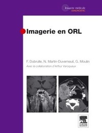 Guy Moulin et Nadine Martin-Duverneuil - Imagerie en ORL.