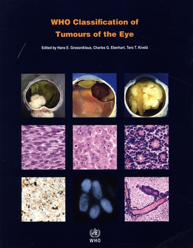 Who Classification of Tumours of the Eye
