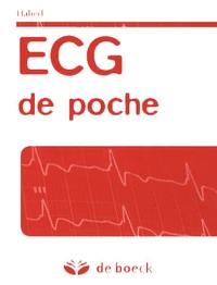 ECG de poche