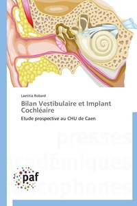  Robard-l - Bilan vestibulaire et implant cochléaire.