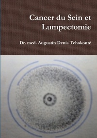 Dr. med. augustin denis Tchokonté - Cancer du Sein et Lumpectomie.