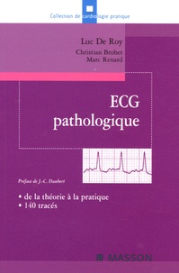 Luc De Roy et Christian Brohet - ECG pathologique - De la théorie à la pratique, 140 tracés.