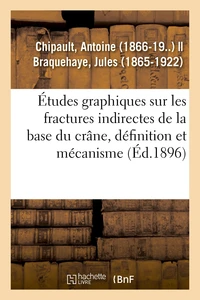 Études graphiques sur les fractures indirectes de la base du crâne, définition et mécanisme