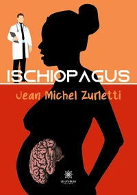 Ischiopagus