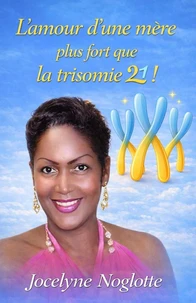 L'amour d'une mère plus fort que la Trisomie 21 !