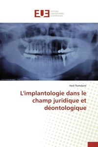 L'implantologie dans le champ juridique et déontologique