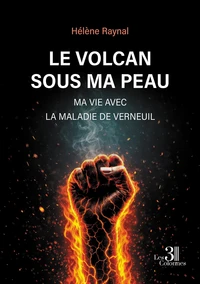Le volcan sous ma peau