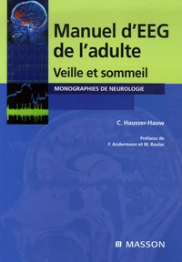 Manuel d'électroencéphalogramme de l'adulte