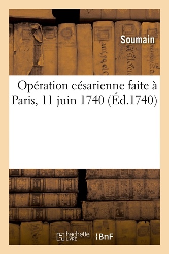 Opération césarienne faite à Paris, 11 juin 1740