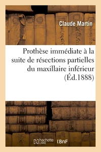 Prothèse immédiate à la suite de résections partielles du maxillaire inférieur