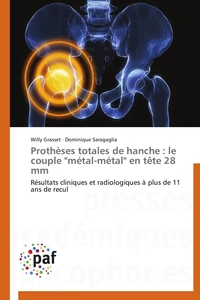 Prothèses totales de hanche : le couple "métal-métal" en tête 28 mm