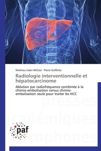  Collectif - Radiologie interventionnelle et hépatocarcinome.