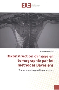 Reconstruction d'image en tomographie par les méthodes Bayésiens