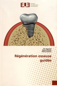 Régénération osseuse guidée