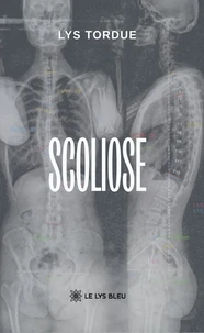 Scoliose