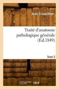 Jean Cruveilhier - Traité d'anatomie pathologique générale. Tome 2.