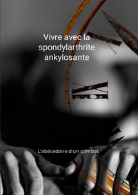 Vivre avec la spondylarthrite ankylosante