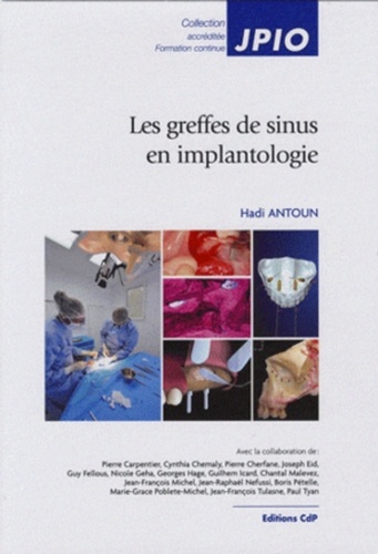 Hadi Antoun - Les greffes de sinus en implantologie.