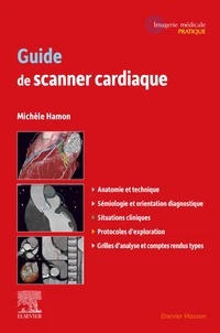 Guide de scanner cardiaque